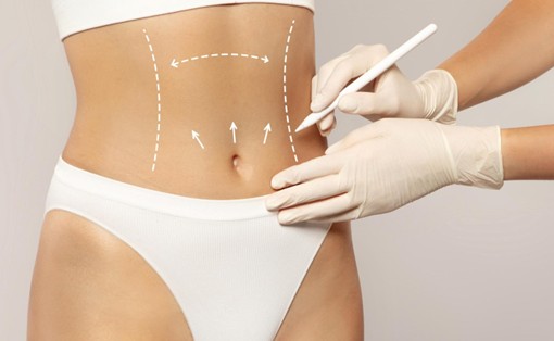 Mujer haciendo turismo médico en Medellín