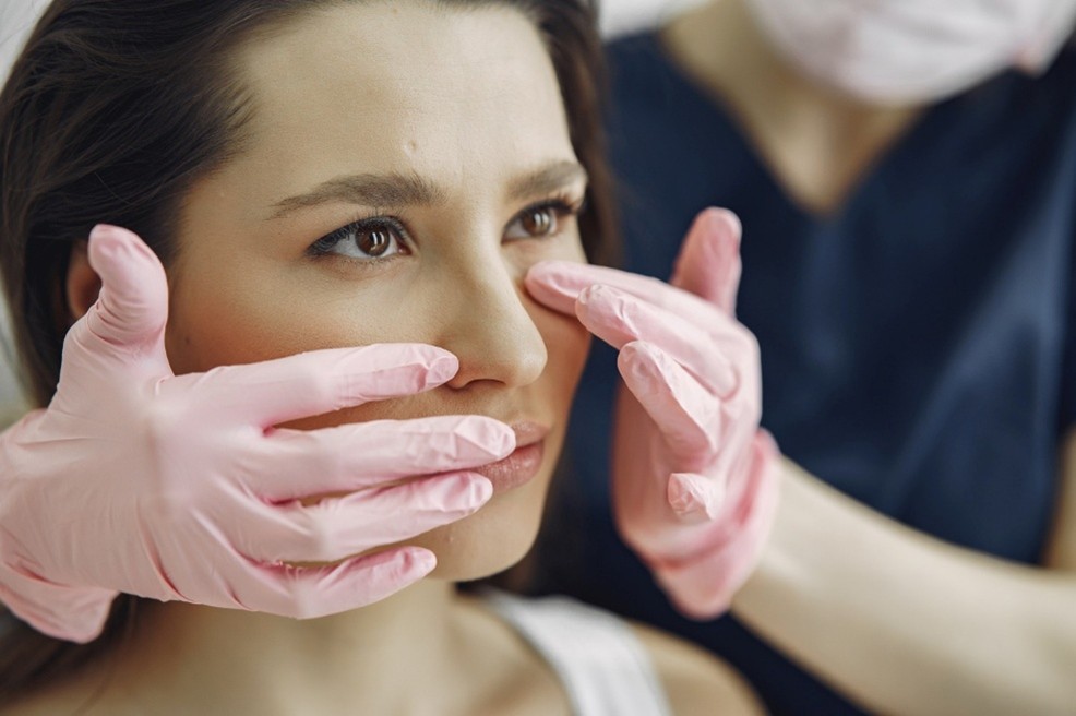 rinoplastia
